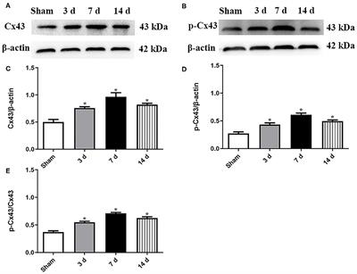 Synaptic Plasticity After Focal Cerebral Ischemia Was Attenuated by Gap26 but Enhanced by GAP-134